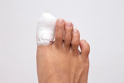 Reasons for a Fractured Toe