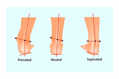 How Pronation Affects the Health of Your Feet