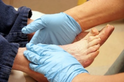 How Foot Function in Diabetic Patients Relates to Limb Salvage