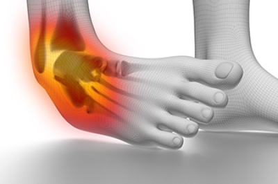 Types and Treatment of Ankle Sprains